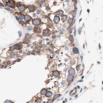 HSP90AA1 antibody|HSP90AA1抗体 F