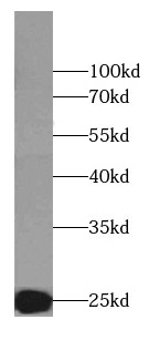 EIF4E antibody|EIF4E抗体 FNab013