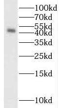 S1PR2 antibody|S1PR2抗体