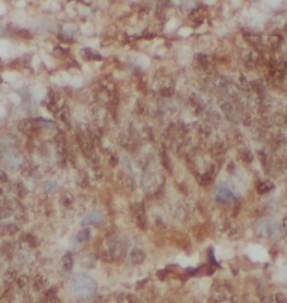 NCOR1 antibody|NCOR1抗体 FNab100