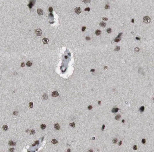 PPP2R3C antibody|PPP2R3C抗体