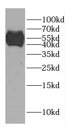 CCDC62 antibody|CCDC62抗体
