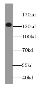 DGKK-Specific antibody|DGKK抗体