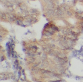 PLD2 antibody|PLD2抗体