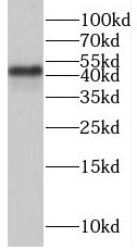 SAMSN1 antibody|SAMSN1抗体