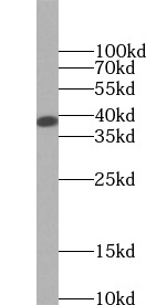 SIRT2 antibody|SIRT2抗体