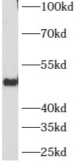 ATG12 antibody|ATG12抗体 FNab006