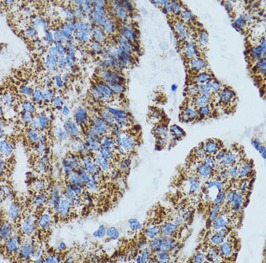 MRPL28 antibody|MRPL28抗体