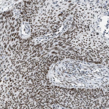 TCF12 antibody|TCF12抗体