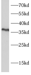 PSTPIP2 antibody|PSTPIP2抗体