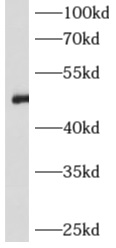 AGT antibody|AGT抗体 FNab00394