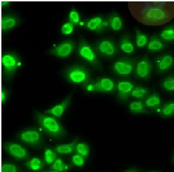 EWSR1 antibody|EWSR1抗体 FNab101