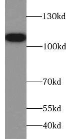 TROAP antibody|TROAP抗体