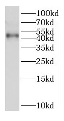 EAF2 antibody|EAF2抗体