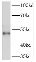 PRKACB antibody|PRKACB抗体
