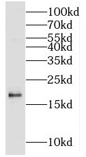 MCEE antibody|MCEE抗体