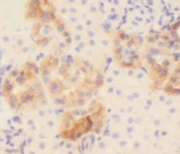 COL6A1 antibody|COL6A1抗体