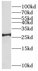 BRMS1 antibody|BRMS1抗体