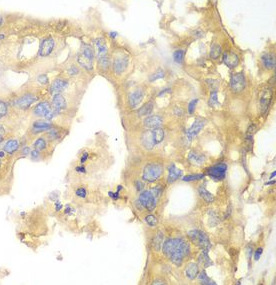 PYGB antibody|PYGB抗体 FNab06973