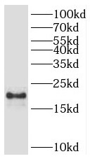 POP7 antibody|POP7抗体