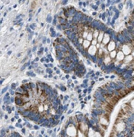 IL31 antibody|IL31抗体