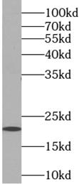 COQ10A antibody|COQ10A抗体