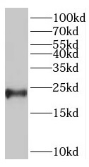 TNNI2 antibody|TNNI2抗体 FNab088