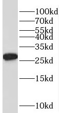 TPD52L2 antibody|TPD52L2抗体