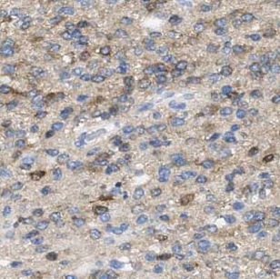 GAS1 antibody|GAS1抗体