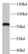 TGFBI antibody|TGFBI抗体 FNab086