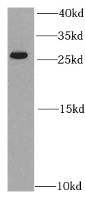 PSMA2 antibody|PSMA2抗体