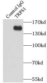 TIMM23 antibody|TIMM23抗体
