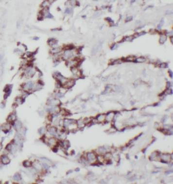 STX12 antibody|STX12抗体