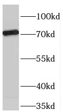 TBX2 antibody|TBX2抗体 FNab08536