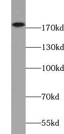 ERBB2 antibody|ERBB2抗体 FNab038