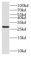CUTC antibody|CUTC抗体
