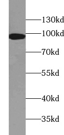 VIL1 antibody|VIL1抗体 FNab09407