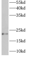 ARL6IP1 antibody|ARL6IP1抗体