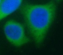 Pre-IL18 antibody|Pre-IL18抗体 F