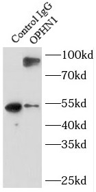 NELFB antibody|NELFB抗体