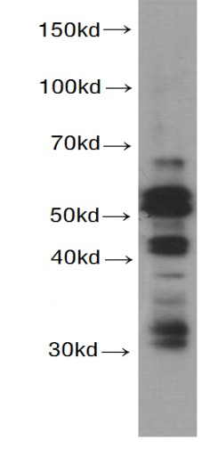 CASP8 antibody|CASP8抗体 FNab012