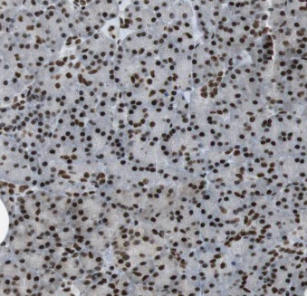 ELF1 antibody|ELF1抗体 FNab02734
