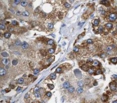 MAP3K3 antibody|MAP3K3抗体 FNab0