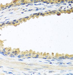 COCH antibody|COCH抗体