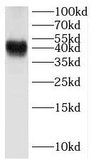 DMTN antibody|DMTN抗体