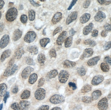 DACH1 antibody|DACH1抗体