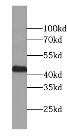 ZNF385D antibody|ZNF385D抗体