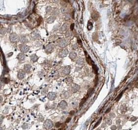 MIF antibody|MIF抗体