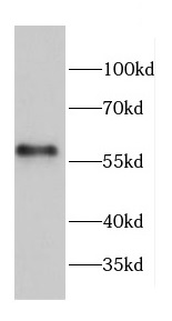 CCT7 antibody|CCT7抗体