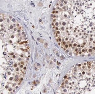 CHMP1A antibody|CHMP1A抗体